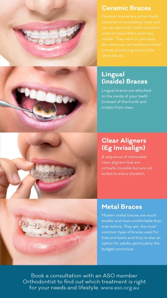 Orthodontist Monroe Ga