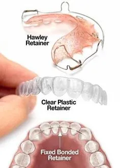 OAI Before and After Smile Gallery Mt. Pleasant IA, ORTHODONTIC ASSOCIATES  of IOWA